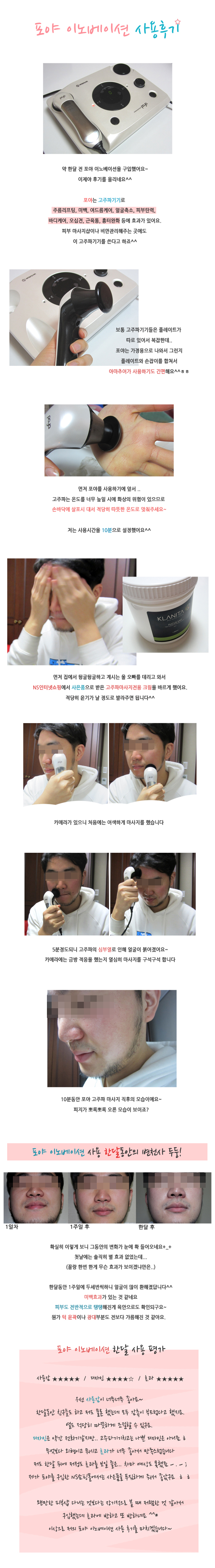 [포야이노베이션] 포야 고주파 마사지기 사용후기(한달동안)~!